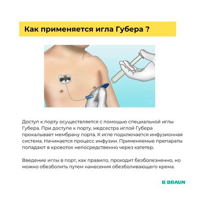 Инструкция использования иглы Губера